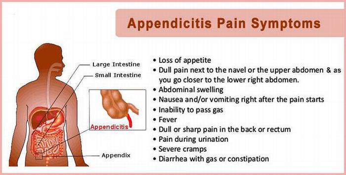 appendicitis symptoms signs warning health gas pain tips if don know week dangerous kill catch sure even very make medical
