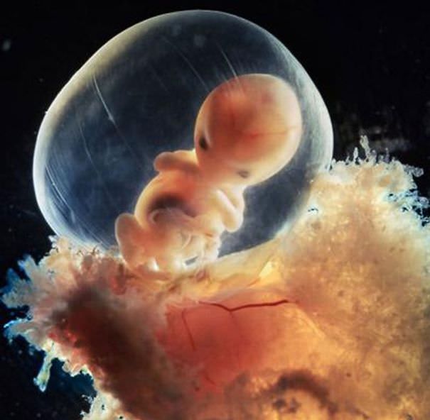 The Phenomenal Miracle of How Life Begins