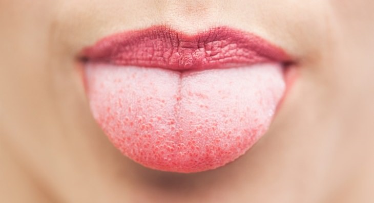 10-natural-remedies-to-heal-a-burnt-tongue-health-babamail