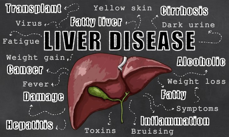 Alarming Signs And Symptoms Of Liver Disease That Shouldn T Be My Xxx Hot Girl