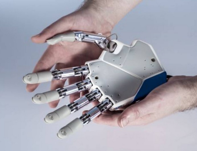 Bionic Hand that Actually Feels