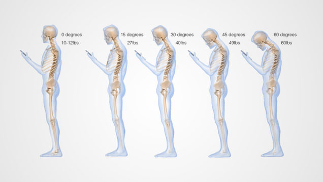 phone spinal injury - skeletons tilting their head at different angles