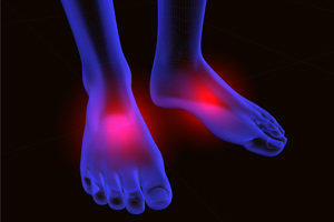 feet neuropathy