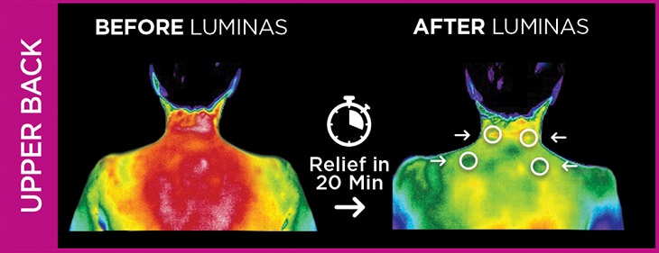 luminas before and after upper back