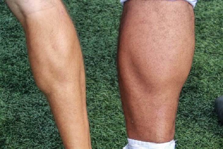 difference in comparison of random things, Calves of A 160 pound rugby player and a 360 pound rugby player
