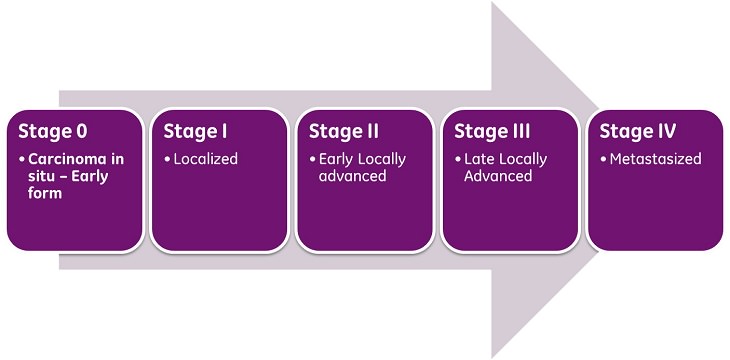 Cancer Detection Blood Test stages of cancer chart