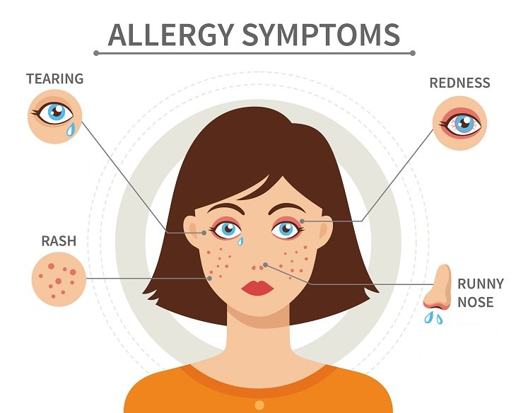 silent signs of allergies common symptoms