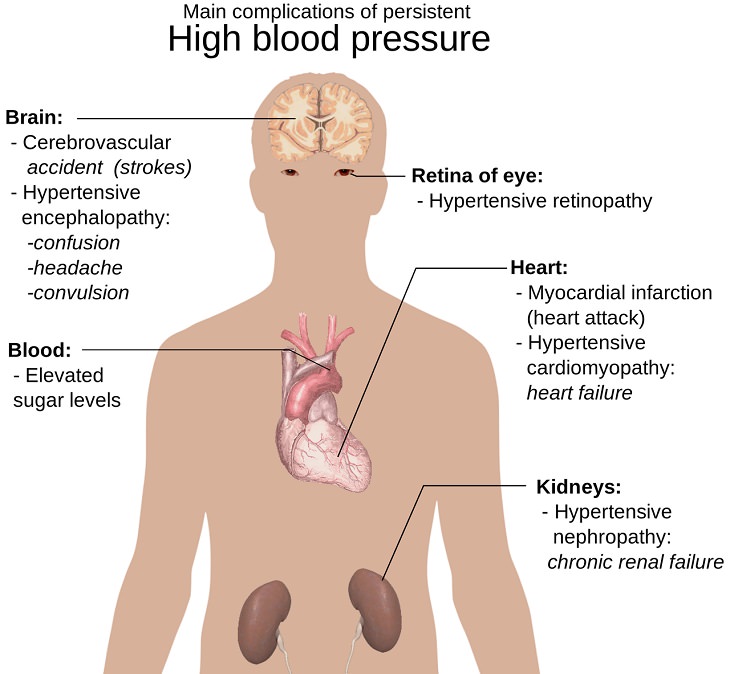 health, hypertension, family and parenting, Alzheimer's disease, trial, high blood pressure, drug, Nilvadipine