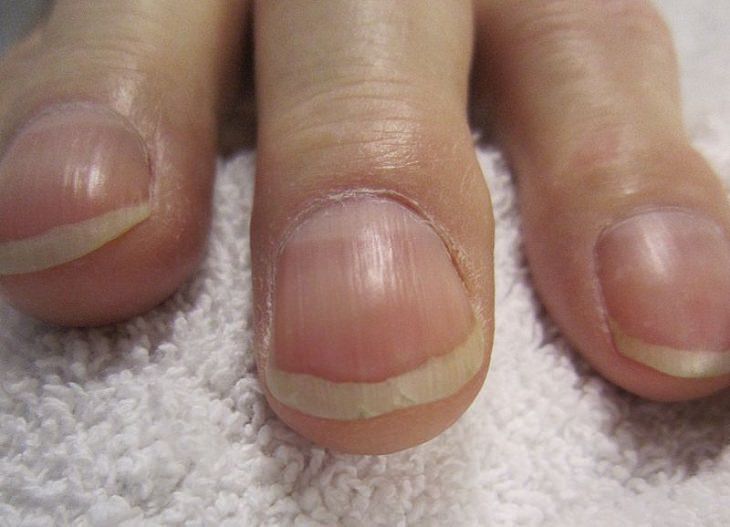 Names of everyday items you didn’t know, Close-up of fingernails with white crescent at the bottom highlighted, lunula