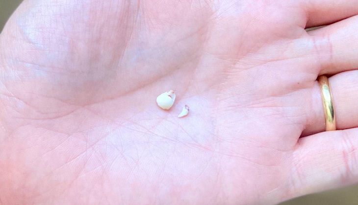 Amazing photographs that show differences, shapes and sizes through comparison, A child’s baby tooth and a kitten’s baby tooth