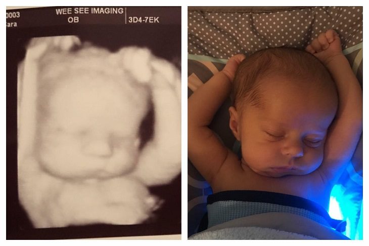 Amazing photographs that show differences, shapes and sizes through comparison, An ultrasound from 3 weeks prior to being born, and a picture taken 3 weeks after