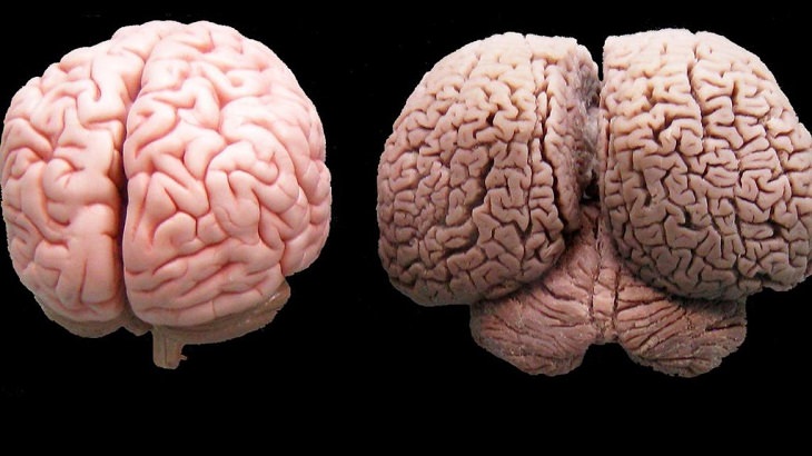 Amazing photographs that show differences, shapes and sizes through comparison, A human brain (left) and a dolphin brain (right)