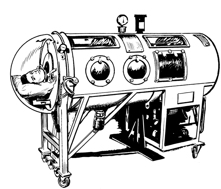 Iron Lungs Bizarre Medical Practices