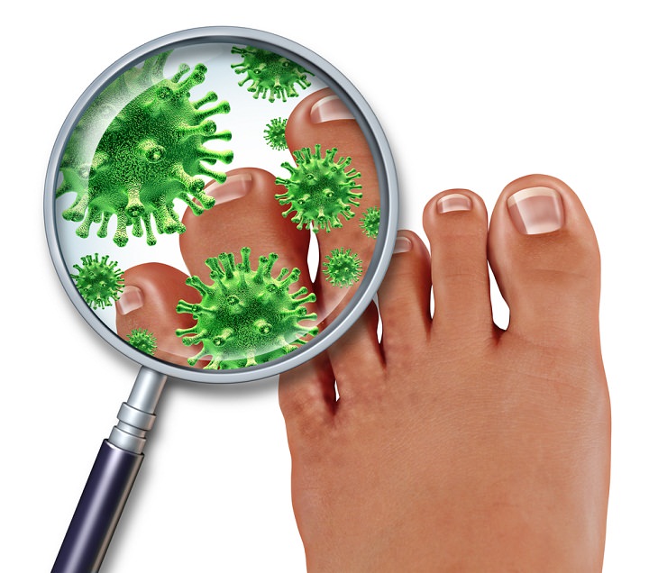 COVID-19 Symptoms, COVID toes