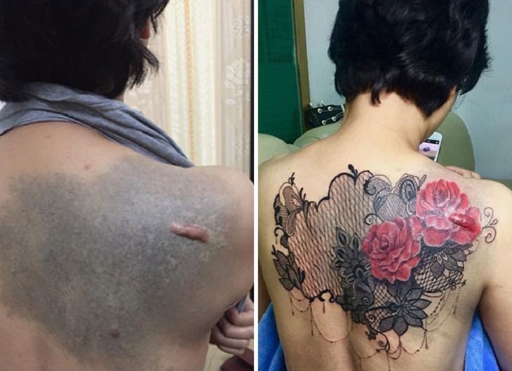 Beautiful tattoos by Vietnamese artist NGOC that hide and cover up skin defects, scars, birth marks and other marks