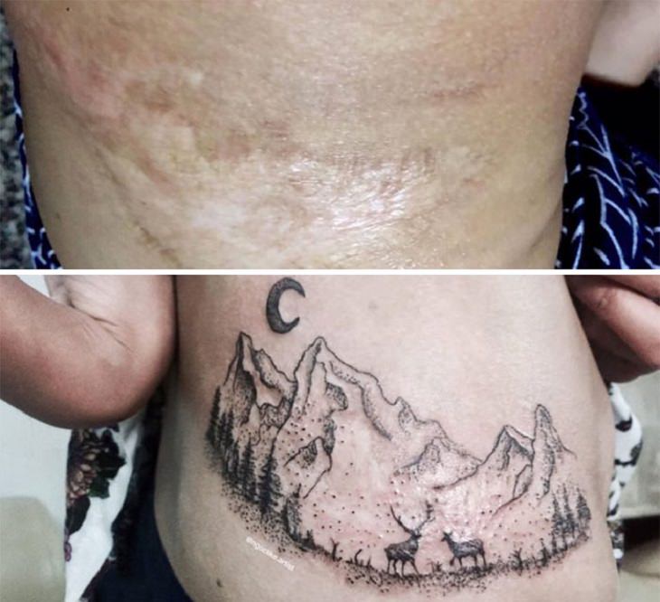 Artist Turns Scars Into Beautiful Tattoos
