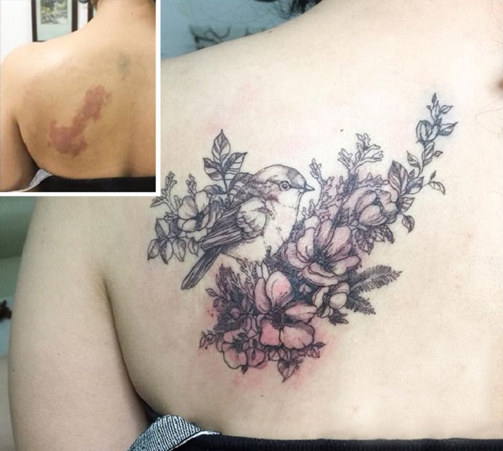 Beautiful tattoos by Vietnamese artist NGOC that hide and cover up skin defects, scars, birth marks and other marks