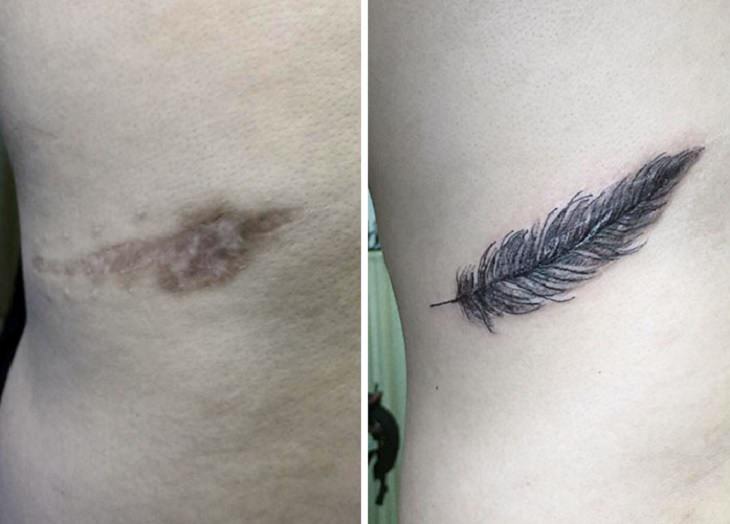 Artist Turns Scars Into Beautiful Tattoos