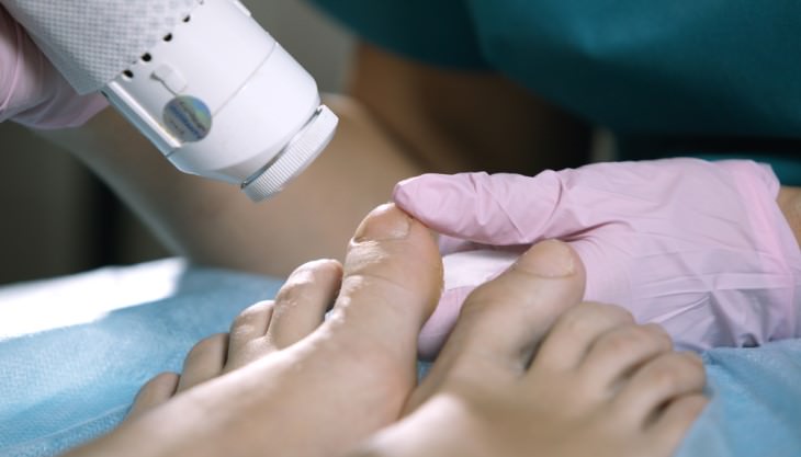 treating feet