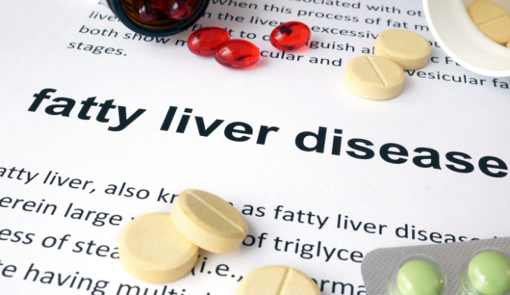 fatty liver definition 