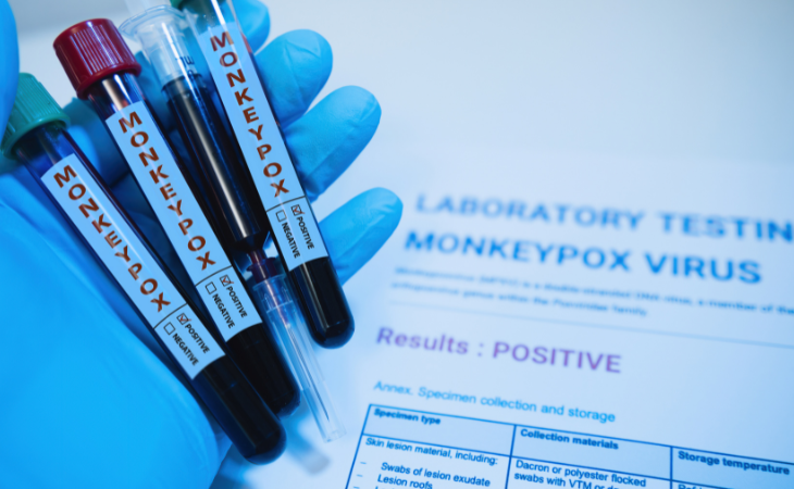 monkey pox testing