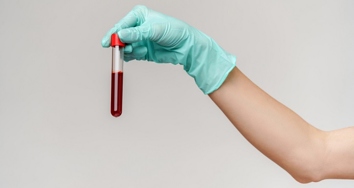 blood test