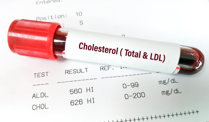 cholesterol