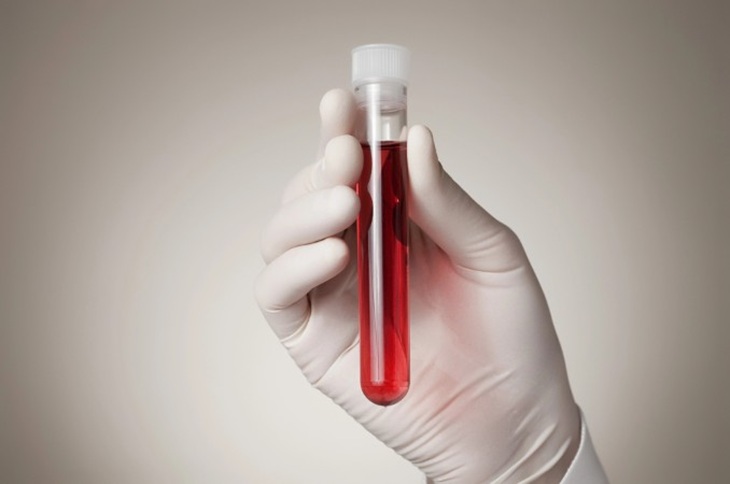 blood test