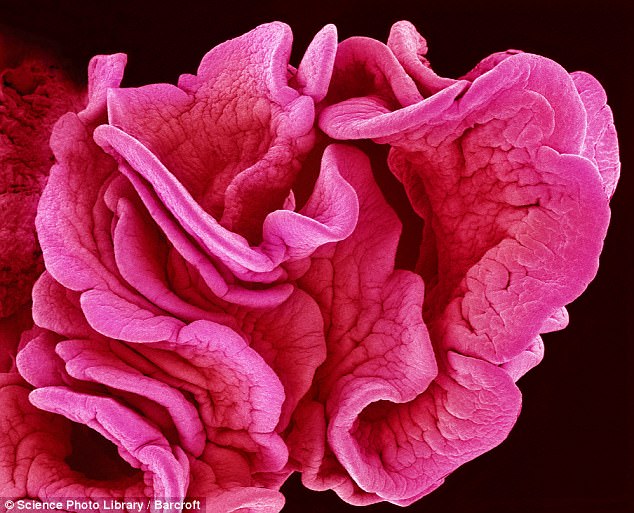 microscopic photo of a tissue