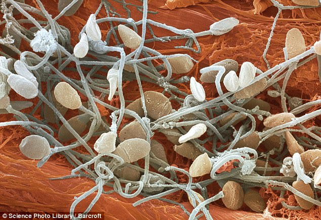 microscopic photo of a human sperm