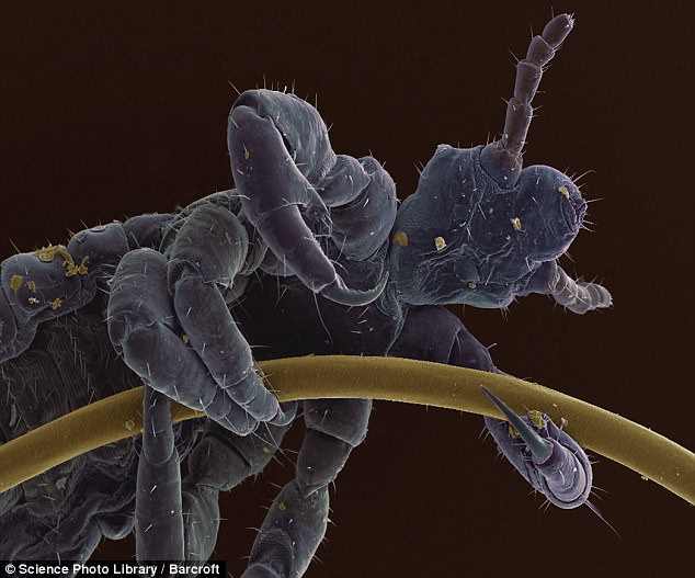 a human head louse clings to a strand of hair
