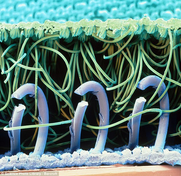 microscopic photo of nylon