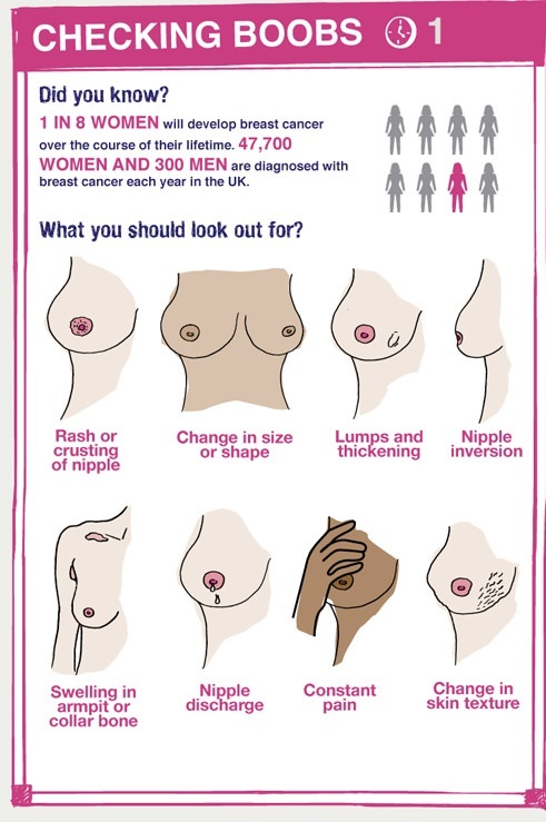 Benign breast lumps