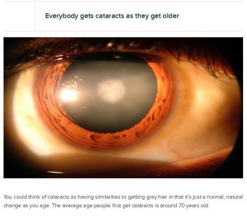 eye information