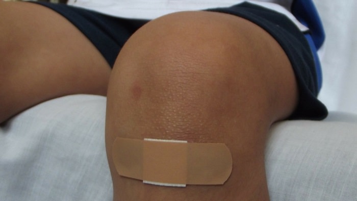 Household Injuries - band aid on knee of man with shorts