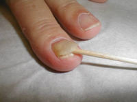 Nails & Health
