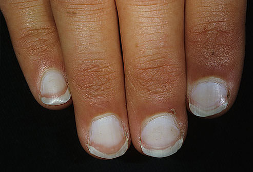 Nails & Health