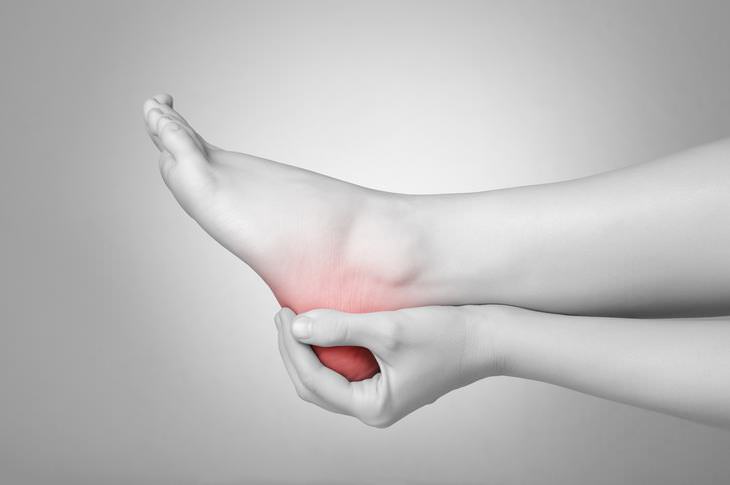 Plantar Fasciitis