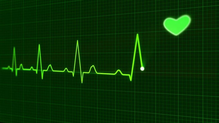 irregular heartbeat causes