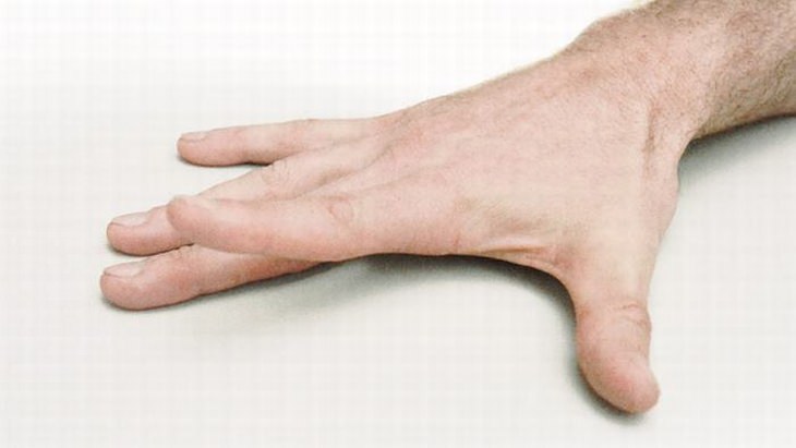 hand-pain