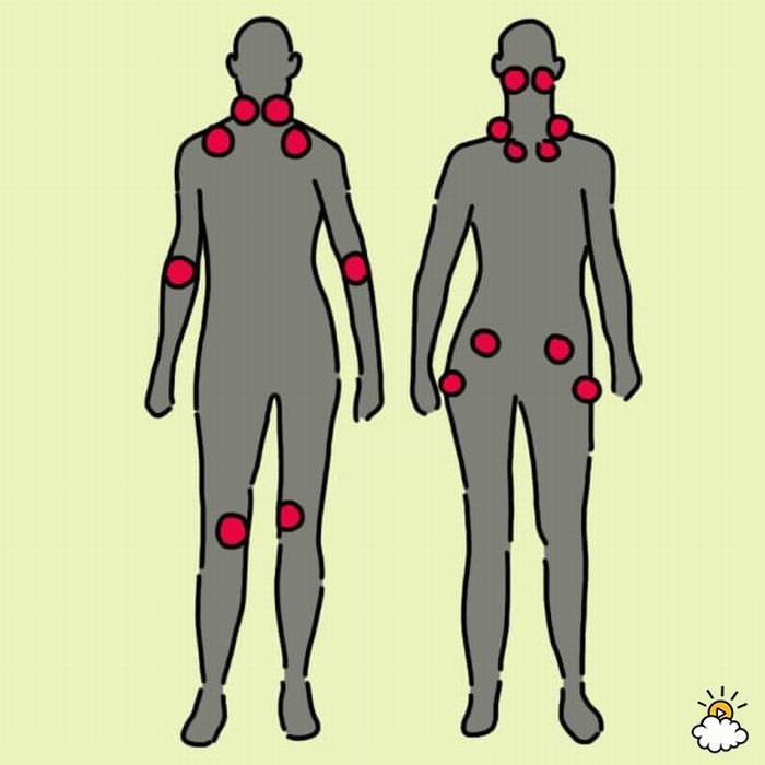 Больные точки. Уязвимые болевые точки на теле человека. Фибромиалгия болевые точки. Самые болевые места у человека. Самые больные точки человека.