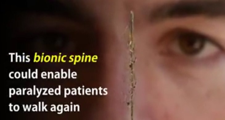 bionic spine