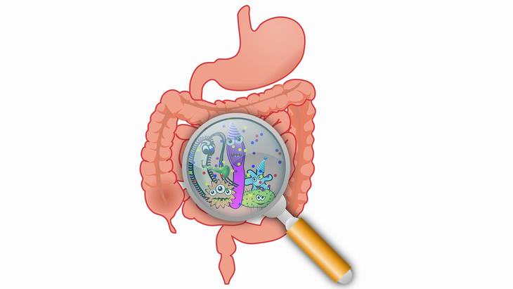 Crohn's Disease