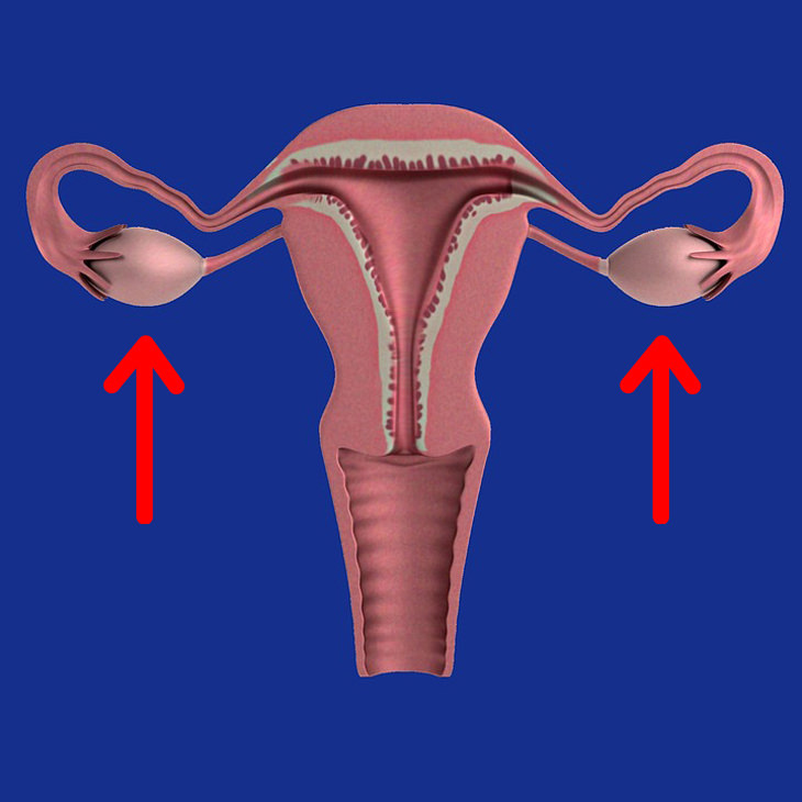 IMPORTANT to Know: 8 Early Signs of Ovarian Cancer