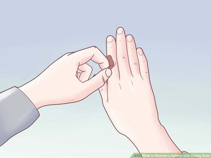 Remove a Splinter - With Baking Soda