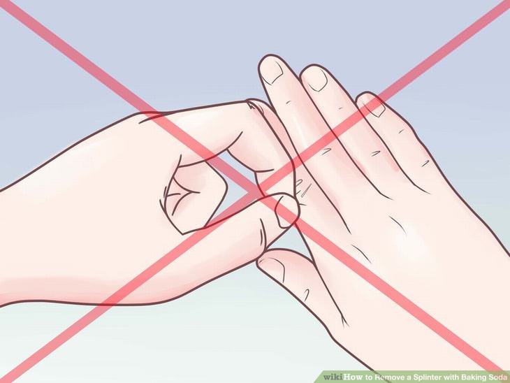 Remove a Splinter - With Baking Soda