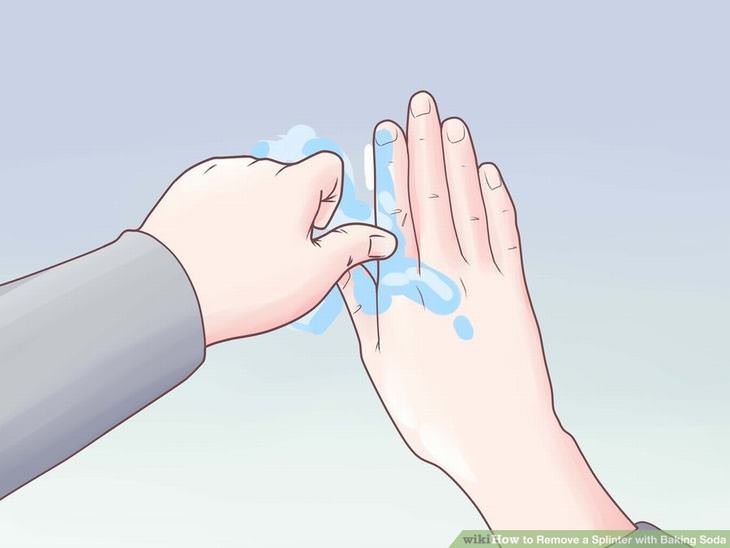 Remove a Splinter - With Baking Soda