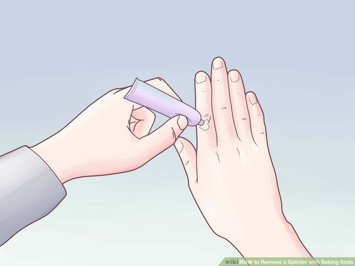 Remove a Splinter - With Baking Soda