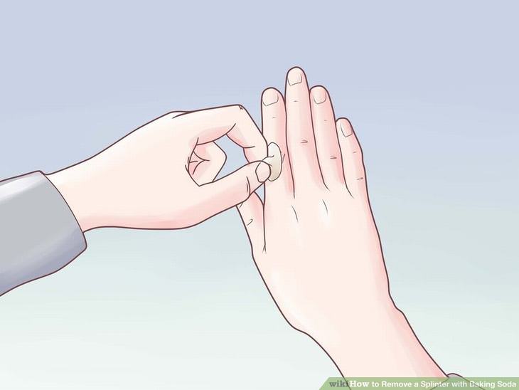 Remove a Splinter - With Baking Soda