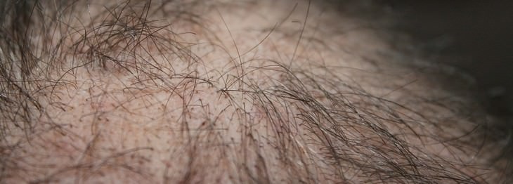 rosemary, hair loss, hair problems